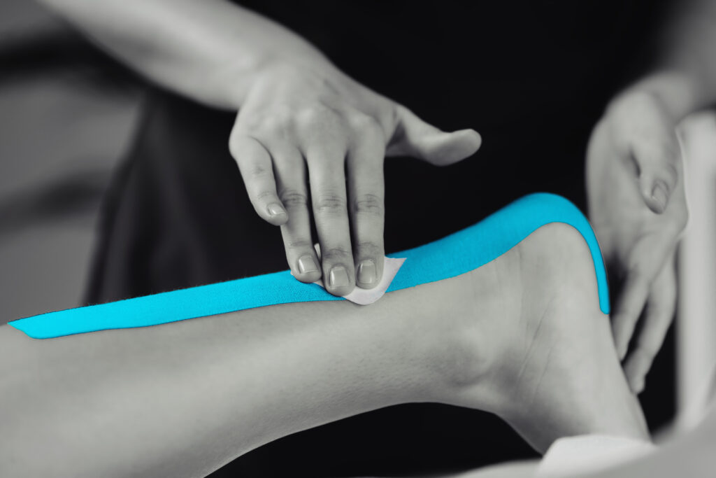 Black and white image of kinesiology taping treatment with blue tape on female patient injured achilles tendon. Sports injury kinesio treatment.
